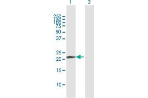 Western Blot analysis of PDE4DIP expression in transfected 293T cell line by PDE4DIP MaxPab polyclonal antibody. (PDE4DIP Antikörper  (AA 1-177))