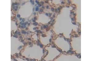 Used in DAB staining on fromalin fixed paraffin- embedded Kidney tissue (NOTCH4 Antikörper  (AA 1690-1945))