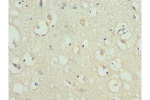 Immunohistochemistry of paraffin-embedded human brain tissue using ABIN7157743 at dilution of 1:100 (KCNIP2 Antikörper  (AA 1-90))