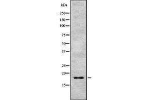 Western blot analysis IL17F using HeLa whole cell lysates (IL17F Antikörper  (Internal Region))