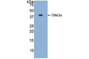 Western blot analysis of recombinant Human CVL. (Ezrin Antikörper  (AA 1-295))