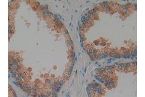 IHC-P analysis of Human Prostate Tissue, with DAB staining. (Proteoglycan 4 Antikörper  (AA 1151-1241))