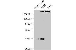 Immunoprecipitating ATM in PC3 whole cell lysate Lane 1: Rabbit control IgG instead of ABIN7127350 in PC3 whole cell lysate. (Rekombinanter ATM Antikörper)