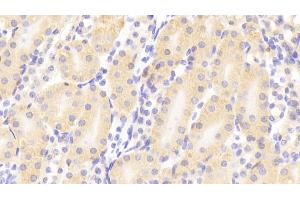 Immunohistochemistry (IHC) image for anti-Matrix Metallopeptidase 10 (Stromelysin 2) (MMP10) (AA 154-472) antibody (ABIN7430972)