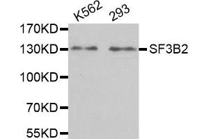 Western Blotting (WB) image for anti-Splicing Factor 3b, Subunit 2, 145kDa (SF3B2) antibody (ABIN1980242) (SF3B2 Antikörper)
