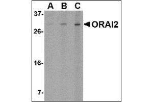 ORAI2 Antikörper  (C-Term)