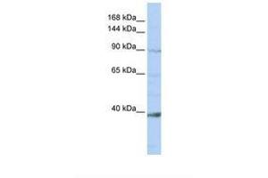 Image no. 1 for anti-NCK-Associated Protein 1-Like (NCKAP1L) (AA 36-85) antibody (ABIN6738379) (NCKAP1L Antikörper  (AA 36-85))