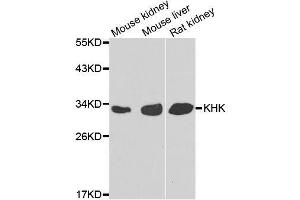 Western blot analysis of extracts of various cell lines, using KHK antibody. (Ketohexokinase Antikörper  (AA 1-298))