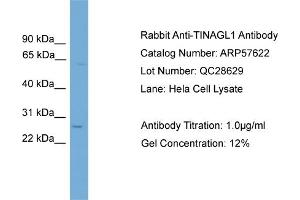 WB Suggested Anti-TINAGL1  Antibody Titration: 0.