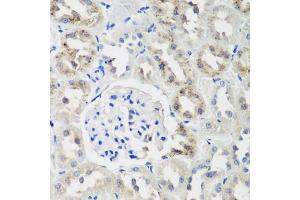 Immunohistochemistry of paraffin-embedded rat kidney using NEDD4L antibody. (NEDD4-2 Antikörper)