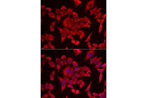 Immunofluorescence analysis of HeLa cell using SLC20A2 antibody. (SLC20A2 Antikörper)
