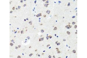 Immunohistochemistry of paraffin-embedded Mouse brain using DLG1 Polyclonal Antibody at dilution of 1:100 (40x lens). (DLG1 Antikörper)