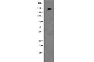 Western blot analysis of JMJD1B expression in Hela cell lysate,The lane on the left is treated with the antigen-specific peptide. (KDM3B Antikörper  (Internal Region))