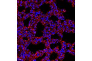 Immunofluorescence (Paraffin-embedded Sections) (IF (p)) image for anti-Myosin Light Chain 6, Alkali, Smooth Muscle and Non Muscle (MYL6) antibody (ABIN7074734)