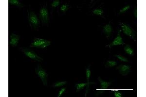 Immunofluorescence of monoclonal antibody to TWIST2 on HeLa cell. (TWIST2 Antikörper  (AA 1-160))