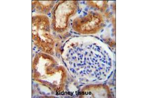 SLC5A12 antibody immunohistochemistry analysis in formalin fixed and paraffin embedded human kidney tissue followed by peroxidase conjugation of the secondary antibody and DAB staining. (SLC5A12 Antikörper  (C-Term))