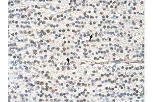 Immunohistochemistry (IHC) image for anti-GTPase Activating Protein and VPS9 Domains 1 (GAPVD1) (N-Term) antibody (ABIN2775423) (GAPVD1 Antikörper  (N-Term))