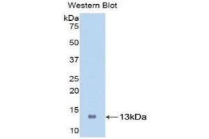 Western Blotting (WB) image for anti-S100 Calcium Binding Protein A8 (S100A8) (AA 1-93) antibody (ABIN3201624)