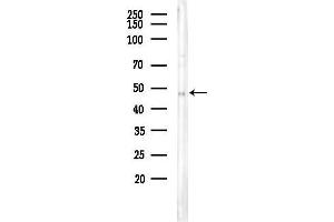 Western blot analysis of lysates from COLO205 cells, using Phospho-CA (Tyr182) Antibody at 1/1000 dilution.
