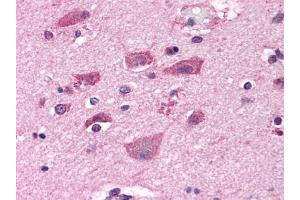 Immunohistochemical staining of Brain (Neurons and Glia) using anti- GRM7 antibody ABIN122320 (GRM7 Antikörper  (N-Term))