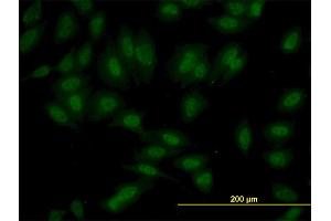 Immunofluorescence of monoclonal antibody to SET7 on HeLa cell. (SETD7 Antikörper  (AA 257-366))