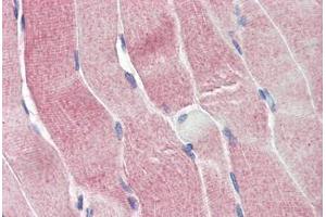 Human Skeletal Muscle (formalin-fixed, paraffin-embedded) stained with SIRT4 antibody ABIN337219 at 2. (SIRT4 Antikörper  (AA 302-314))