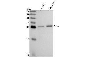 Western blot analysis of NT5M using anti-NT5M antibody (ABIN7601970).