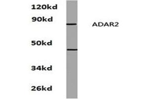 Image no. 1 for anti-Adenosine Deaminase, RNA-Specific, B1 (ADARB1) antibody (ABIN272206)