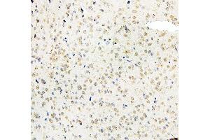 IHC analysis of MID1 using anti-MID1 antibody (ABIN6719400). (MID1 Antikörper  (AA 226-278))