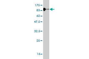 Western Blotting (WB) image for anti-Endoglin (ENG) (AA 27-658) antibody (ABIN560739)