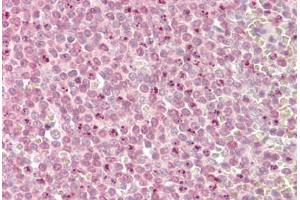 Image no. 1 for anti-Myeloid/lymphoid Or Mixed-Lineage Leukemia 2 (MLL2) (AA 2-14) antibody (ABIN1494780) (MLL2 Antikörper  (AA 2-14))