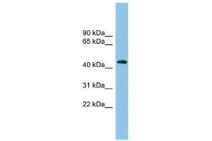 ACTR1B antibody used at 1 ug/ml to detect target protein. (ACTR1B Antikörper)