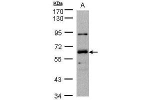 WB Image Sample(30 ug whole cell lysate) A:Hep G2 , 7. (DNAJC1 Antikörper  (Center))