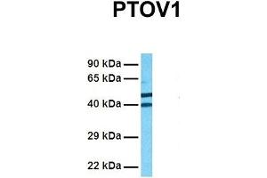 Host:  Rabbit  Target Name:  PTOV1  Sample Tissue:  Human 293T  Antibody Dilution:  1. (PTOV1 Antikörper  (N-Term))