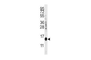 Western blot analysis of anti-CDA Antibody in mouse kidney tissue lysates (35ug/lane) (CDA Antikörper  (C-Term))