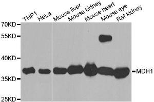 Western blot analysis of extracts of various cell lines, using MDH1 antibody. (MDH1 Antikörper  (AA 1-334))
