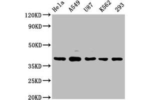 Western Blot Positive WB detected in: Hela whole cell lysate, A549 whole cell lysate, U87 whole cell lysate, K562 whole cell lysate, 293 whole cell lysate All lanes: PIH1D1 antibody at 1:2000 Secondary Goat polyclonal to rabbit IgG at 1/50000 dilution Predicted band size: 33, 20, 22 kDa Observed band size: 39 kDa (PIH1D1 Antikörper  (AA 1-290))
