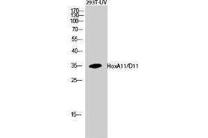 Western Blot (WB) analysis of 293T-UV cells using HoxA11/D11 Polyclonal Antibody. (HOXA11/D11 Antikörper  (C-Term))