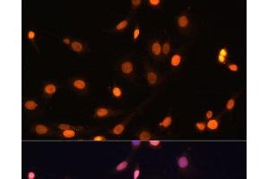 Immunofluorescence analysis of C6 cells using WT1 Polyclonal Antibody at dilution of 1:100. (WT1 Antikörper)