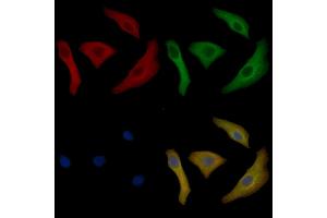 Cytokeratin 17 Mouse Monoclonal Antibody staining Hela cells by IF/ICC. (KRT17 Antikörper  (Internal Region))
