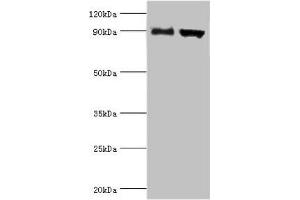 Western blot All lanes: Disintegrin and metalloproteinase domain-containing protein 9 antibody at 2 μg/mL Lane 1: Mouse liver tissue Lane 2: Mouse heart tissue Secondary Goat polyclonal to rabbit IgG at 1/10000 dilution Predicted band size: 91, 73 kDa Observed band size: 91 kDa