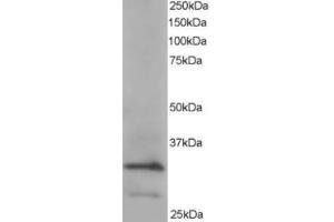 Western Blotting (WB) image for anti-Actin Related Protein 2/3 Complex, Subunit 2, 34kDa (ARPC2) (C-Term) antibody (ABIN2465173) (ARPC2 Antikörper  (C-Term))