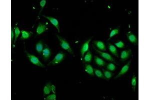 Immunofluorescence staining of A549 cells with ABIN7168378 at 1:166, counter-stained with DAPI. (MSI1 Antikörper  (AA 221-347))