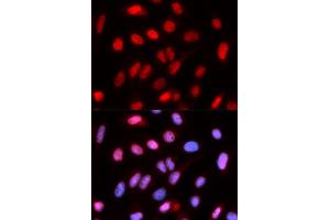 Immunofluorescence analysis of U2OS cells using RFC4 antibody (ABIN5973195). (RFC4 Antikörper)