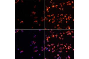Immunofluorescence analysis of Jurkat cells using CASP3 antibody (ABIN6292881) at dilution of 1:100. (Caspase 3 Antikörper)