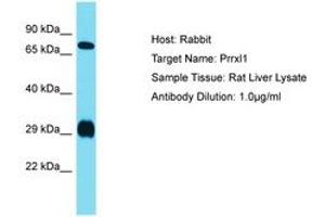 Image no. 1 for anti-Dorsal Root Ganglia Homeobox (DRGX) (N-Term) antibody (ABIN6750247) (DRGX Antikörper  (N-Term))