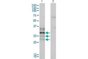 Western Blot analysis of NFATC2IP expression in transfected 293T cell line by NFATC2IP monoclonal antibody (M01), clone 2D7-A10.
