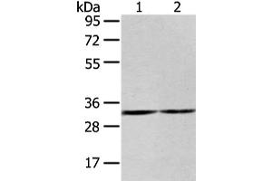 Gel: 8 % SDS-PAGE, Lysate: 40 μg, Lane 1-2: 231 and K562 cell, Primary antibody: ABIN7193107(ZNF146 Antibody) at dilution 1/200 dilution, Secondary antibody: Goat anti rabbit IgG at 1/8000 dilution, Exposure time: 20 seconds (ZNF146 Antikörper)