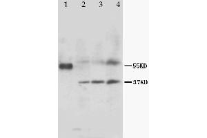 Anti-MRGX1 antibody, Western blotting Lane 1: Marker Lane 2: Rat Heart Tissue Lysate Lane 3: Rat Skeletal Muscle Tissue Lysate Lane 4: MCF-7 Cell Lysate (MRGPRX1 Antikörper  (N-Term))