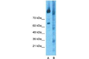 Western Blotting (WB) image for anti-Ring Finger Protein 31 (RNF31) (Middle Region) antibody (ABIN2774753)